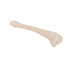 Tibia - Anatomie et pathologie - My Podologie